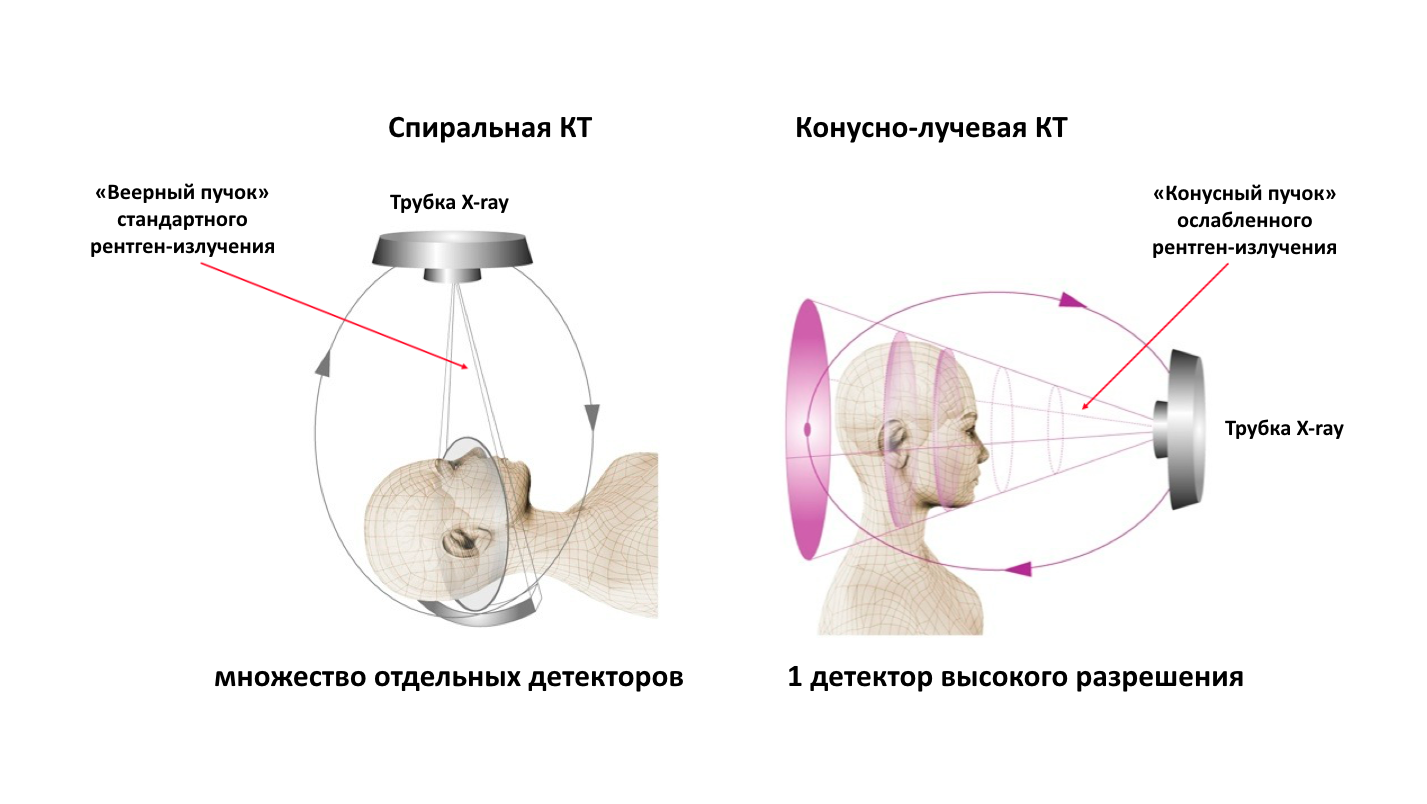 Что такое конусно лучевая компьютерная томография