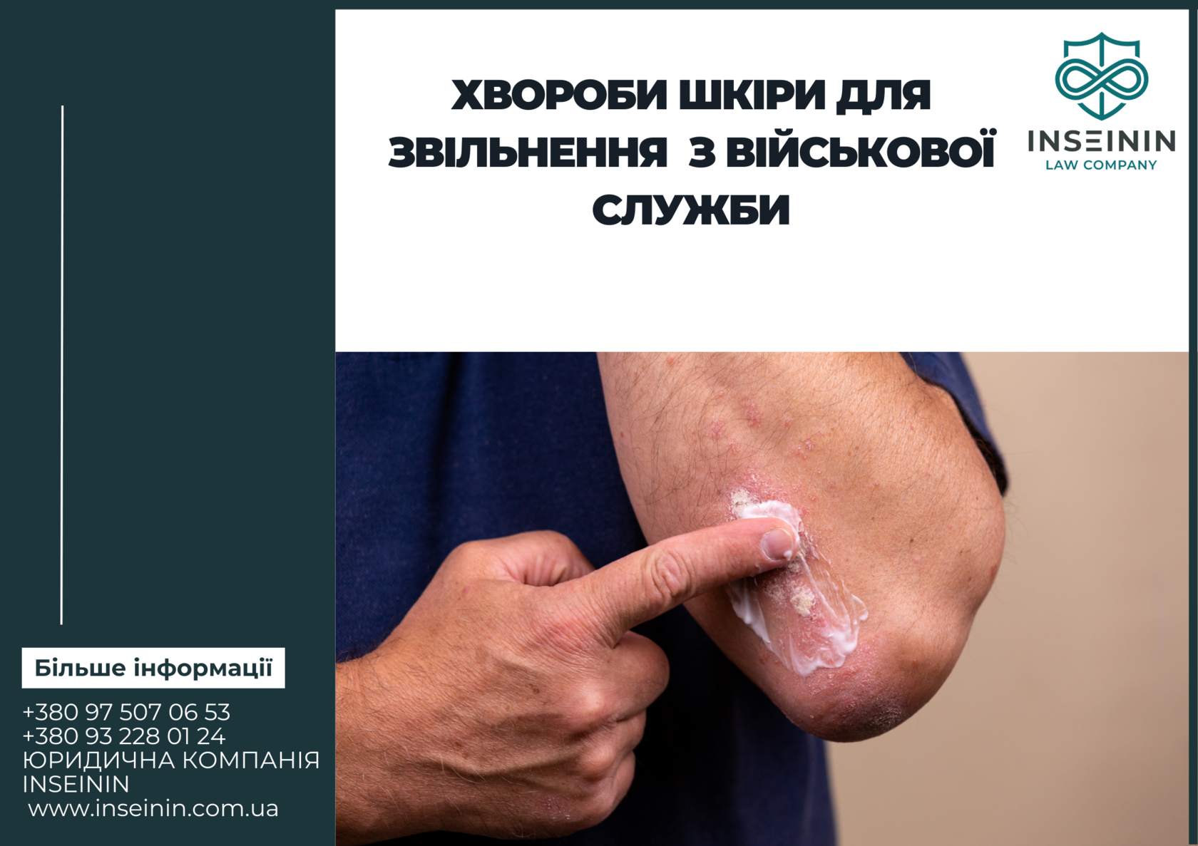 Хвороби шкіри для звільнення з військової служби